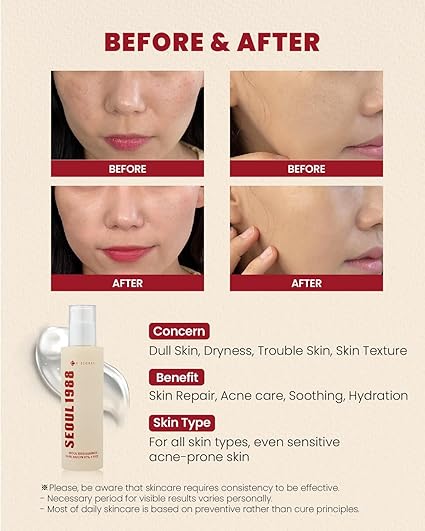 K-SECRET SEOUL 1988 Snail Mucin 97% + Rice Essence 100ml