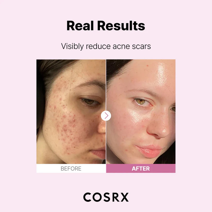 COSRX The Niacinamide 15 Face Serum 20ml
